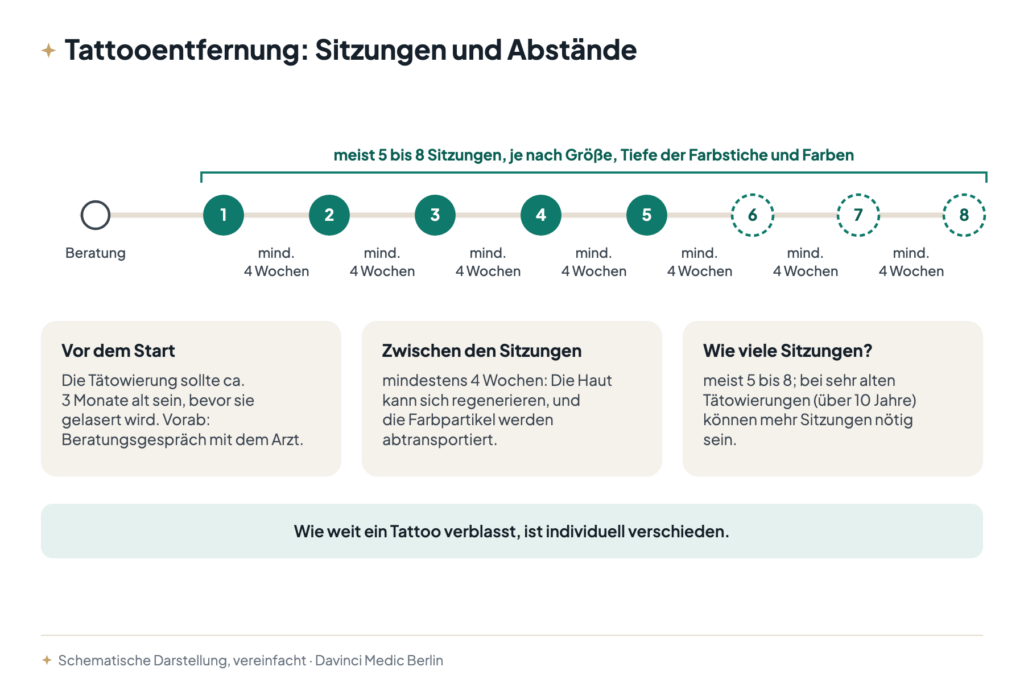 Zeitstrahl zur Tattooentfernung: meist 5 bis 8 Sitzungen mit mindestens 4 Wochen Abstand, vorher Beratung, Tätowierung ca. 3 Monate alt